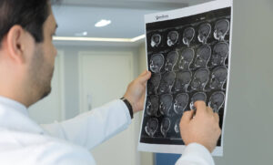 Neurocirurgião analisa ressonância de glioma cerebral