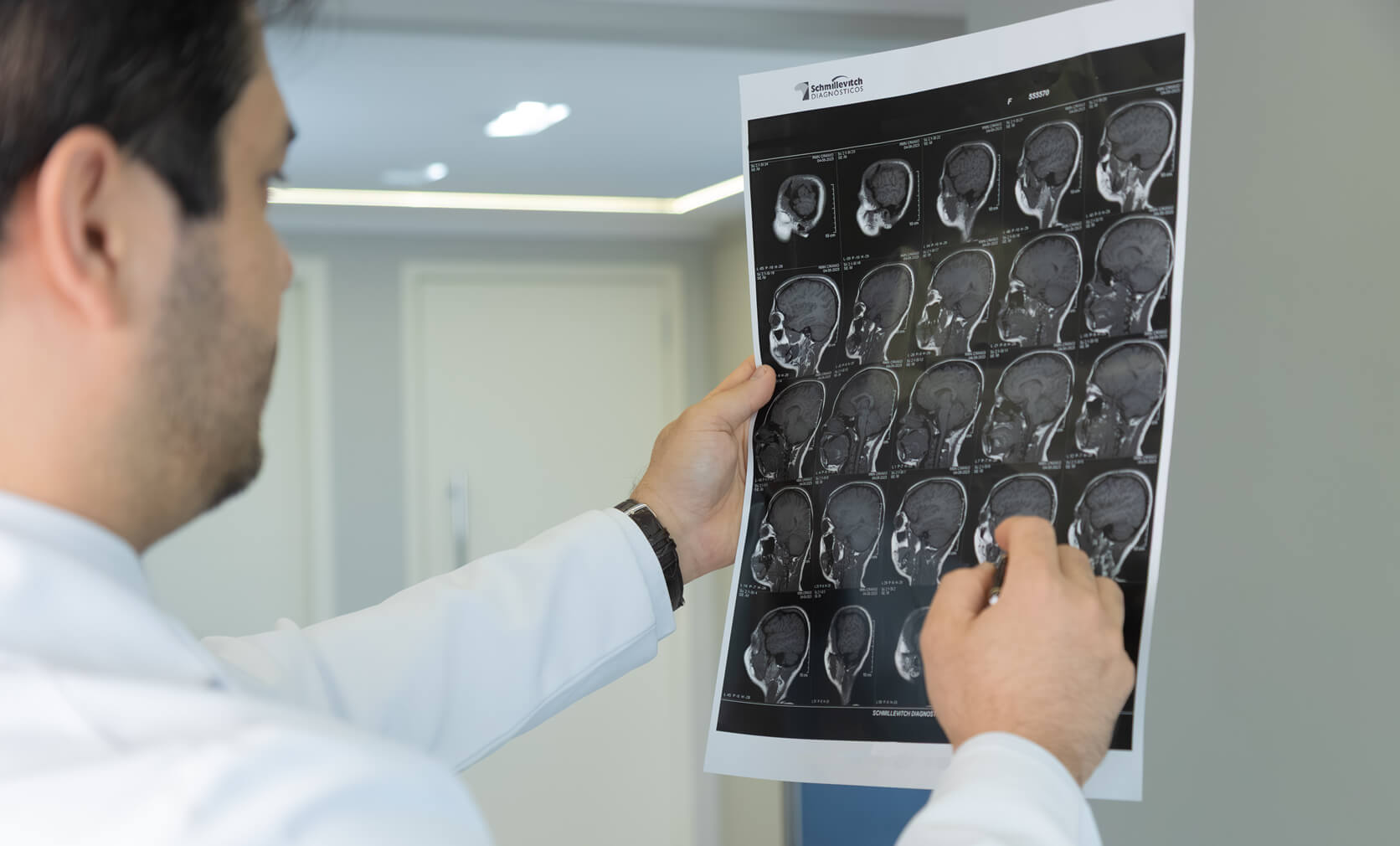 Neurocirurgião analisa ressonância de glioma cerebral