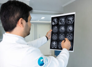 Tumor cerebral tem cura?