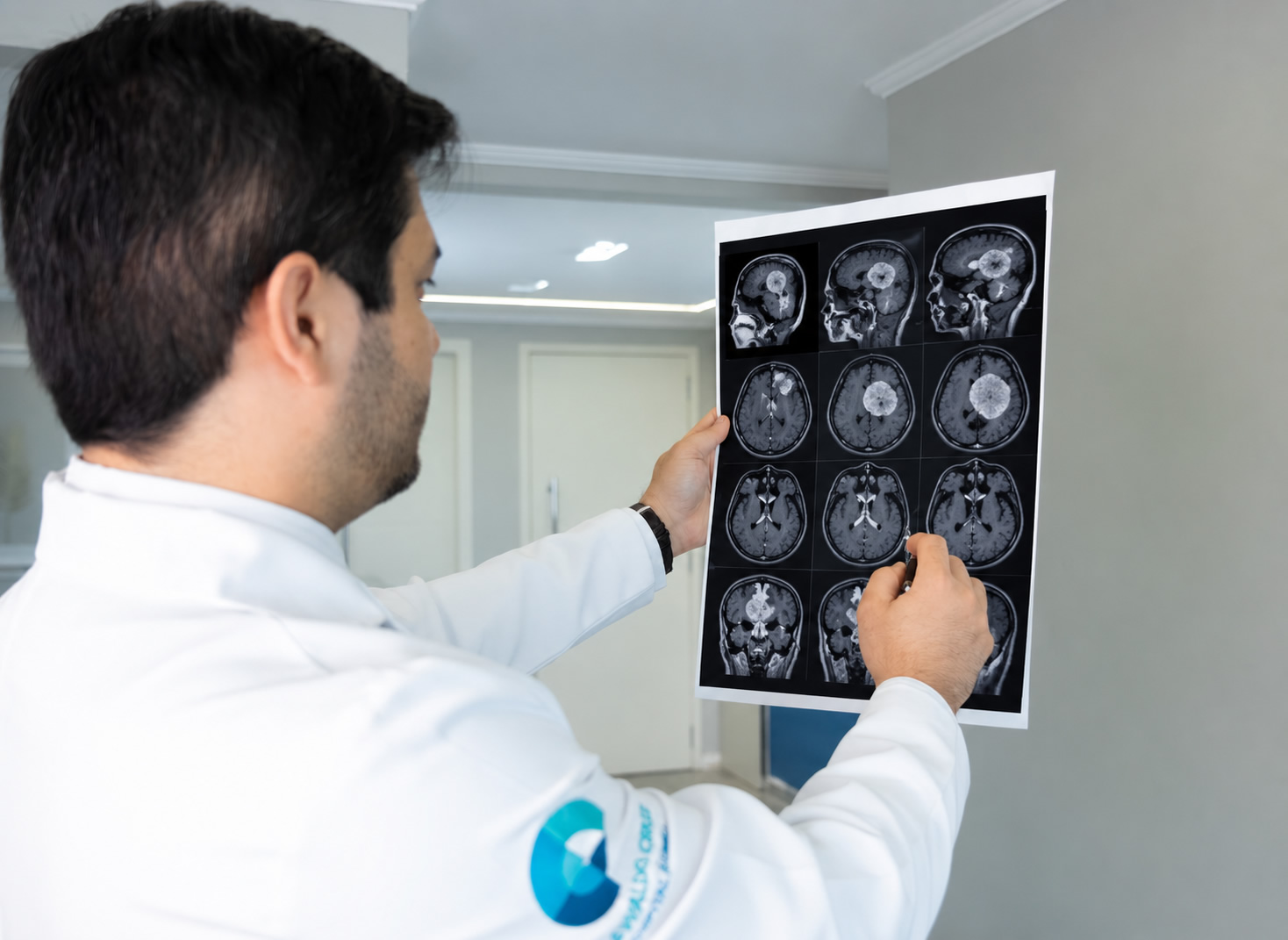 Tumor cerebral tem cura?